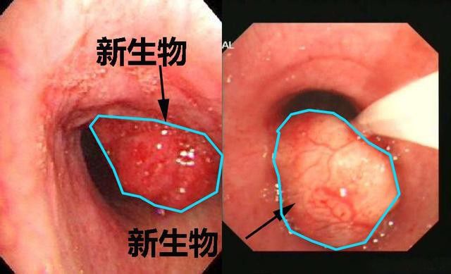 西门子地址_哈尔滨狗不理包子地址_imtoken子地址